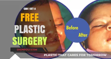 Exploring Options for Free Plastic Surgery: What You Need to Know