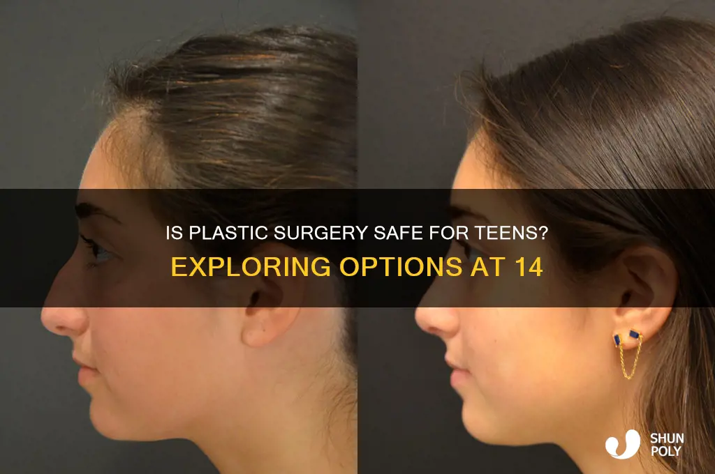 can i get plastic surgery at 14