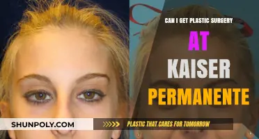 Kaiser Permanente Plastic Surgery: Options, Coverage, and What to Expect