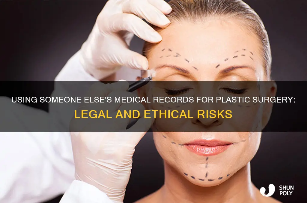 can i get plastic surgery using someone else medical record