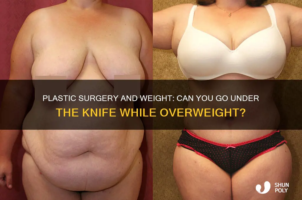 can i get plastic surgery while still fat