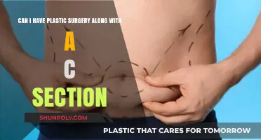 Combining Plastic Surgery with C-Section: Safety, Risks, and Considerations