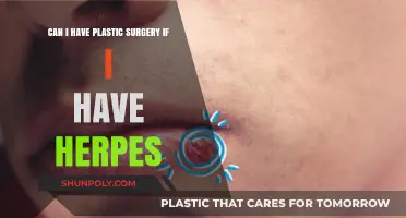 Plastic Surgery with Herpes: What You Need to Know