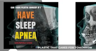 Sleep Apnea and Plastic Surgery: What You Need to Know