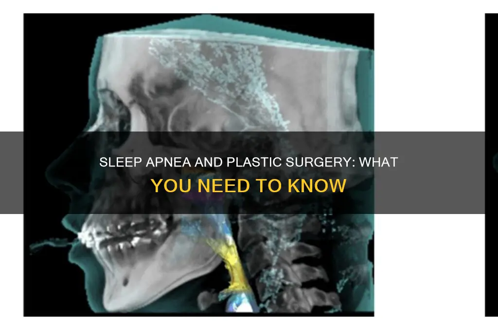 can i have plastic surgery if i have sleep apnea