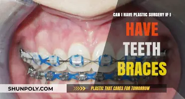 Plastic Surgery with Braces: What You Need to Know