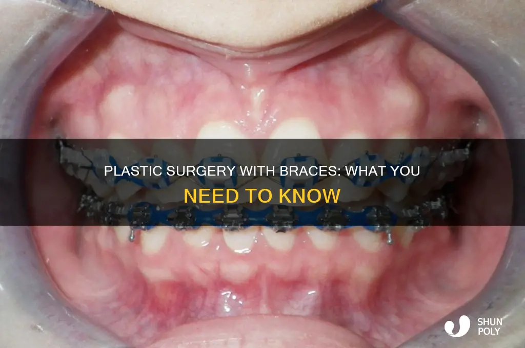can i have plastic surgery if i have teeth braces