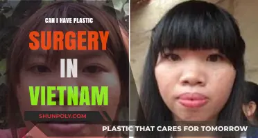 Exploring Plastic Surgery Options in Vietnam: What You Need to Know