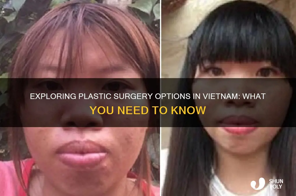 can i have plastic surgery in vietnam