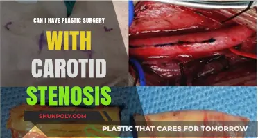 Plastic Surgery Risks with Carotid Stenosis: What You Need to Know