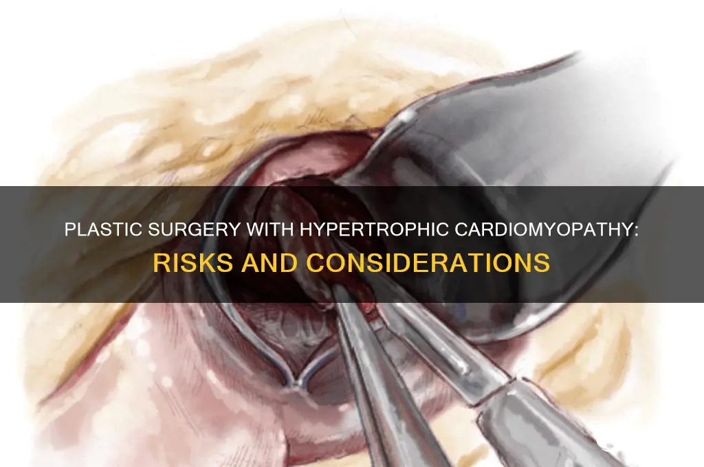 can i have plastic surgery with hypertrophic cardiomyopathy