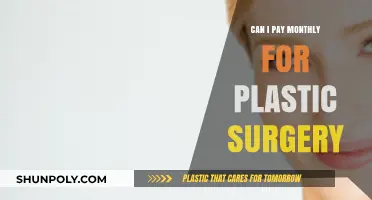 Monthly Payment Plans for Plastic Surgery: What You Need to Know