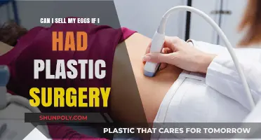 Selling Eggs After Plastic Surgery: What You Need to Know