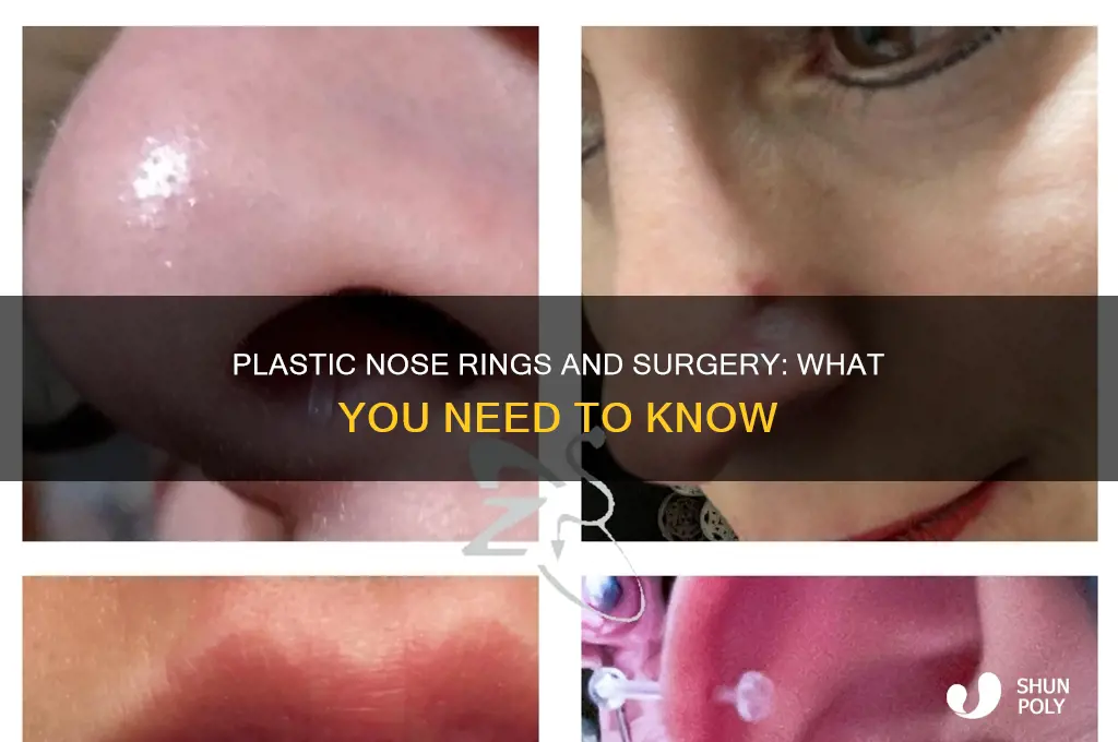 can i wear a plastic nose ring during surgery