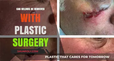 Plastic Surgery for Keloid Removal: Effective Solutions and Considerations
