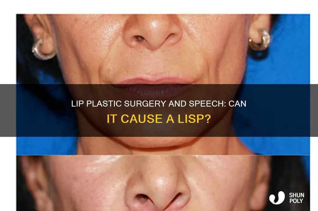 can lip plastic surgery give you a lisp
