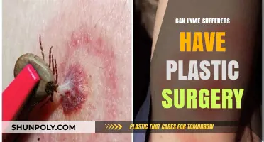 Lyme Disease and Plastic Surgery: Safety Considerations for Patients