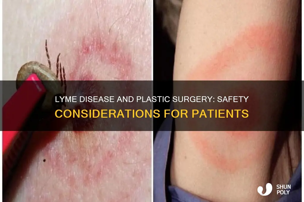 can lyme sufferers have plastic surgery