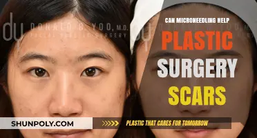 Microneedling for Plastic Surgery Scars: Effective Treatment or Myth?