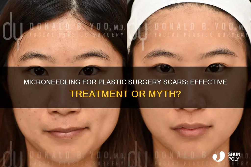 can microneedling help plastic surgery scars