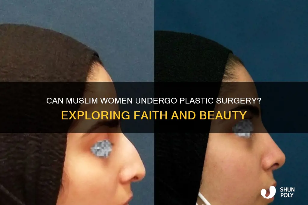 can muslim women get plastic surgery