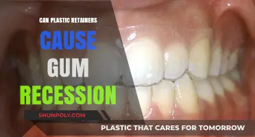 The Truth About Plastic Retainers and Gum Recession: What You Need to Know