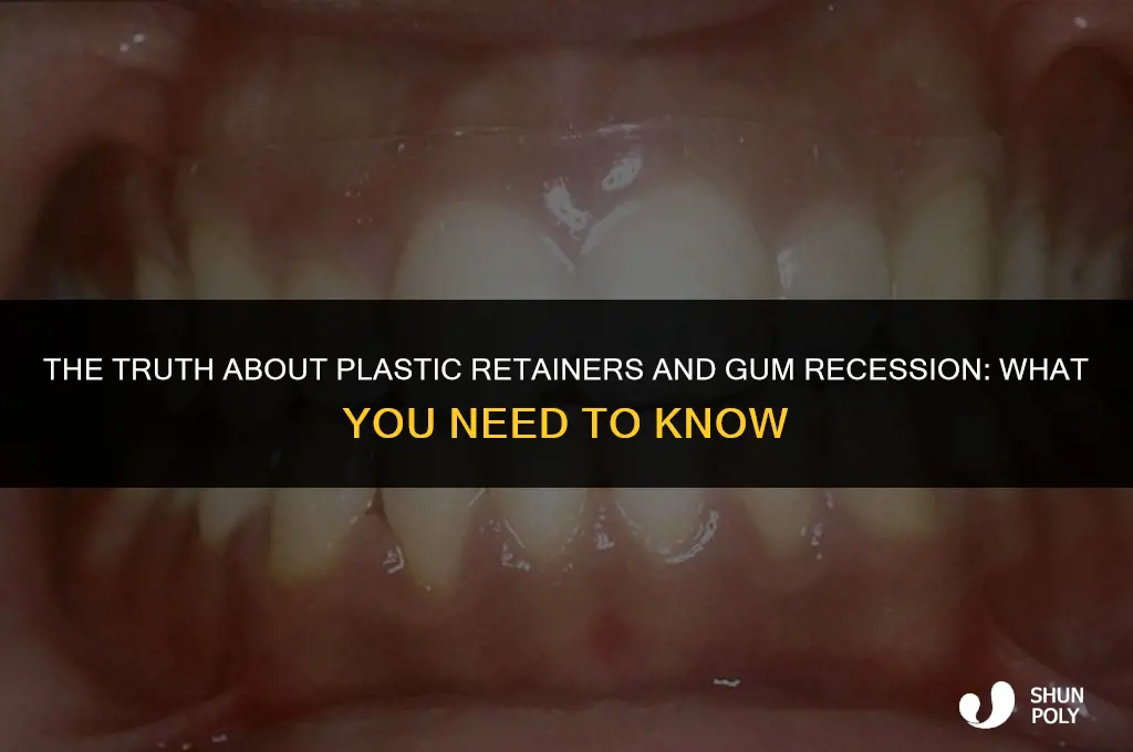 can plastic retainers cause gum recession