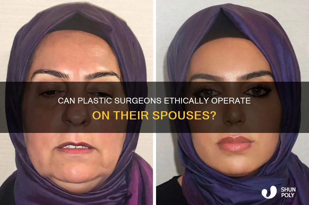 can plastic surgeons perform surgery on wives