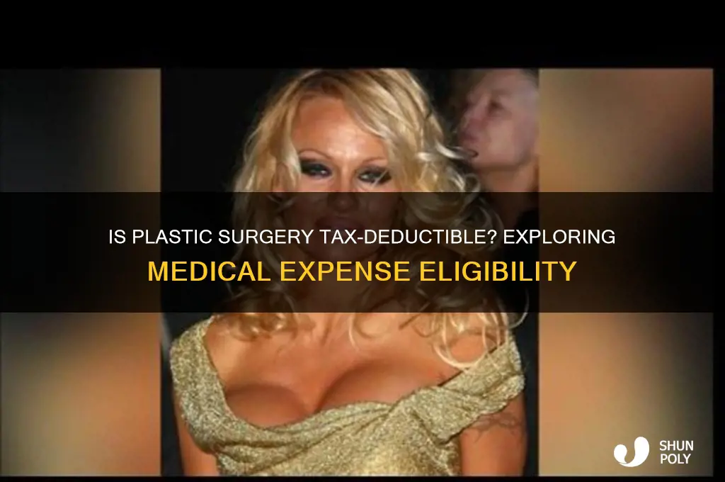 can plastic surgery be deducted as a medical expense