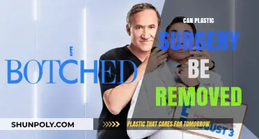 Can Plastic Surgery Be Reversed? Exploring Removal Options and Limitations