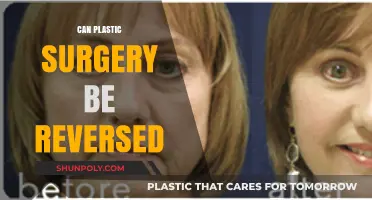 Reversing Plastic Surgery: Exploring Options to Undo Cosmetic Procedures
