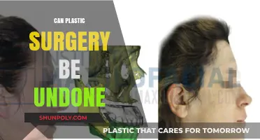 Reversing Plastic Surgery: Can Procedures Be Undone or Corrected?