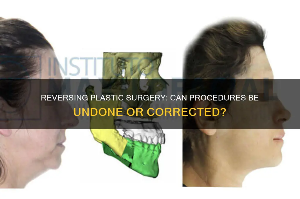 can plastic surgery be undone