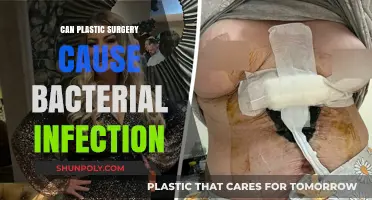 Plastic Surgery and Bacterial Infections: Risks, Prevention, and Treatment
