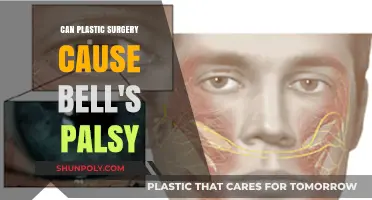 Can Plastic Surgery Lead to Bell's Palsy? Risks Explained