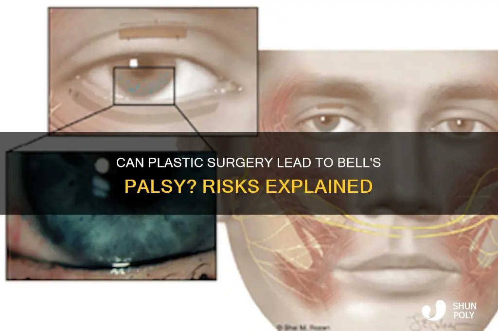 can plastic surgery cause bell