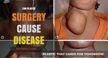 Plastic Surgery and Health Risks: Uncovering Potential Disease Connections