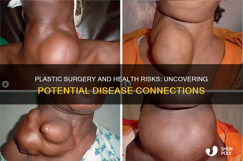 can plastic surgery cause disease