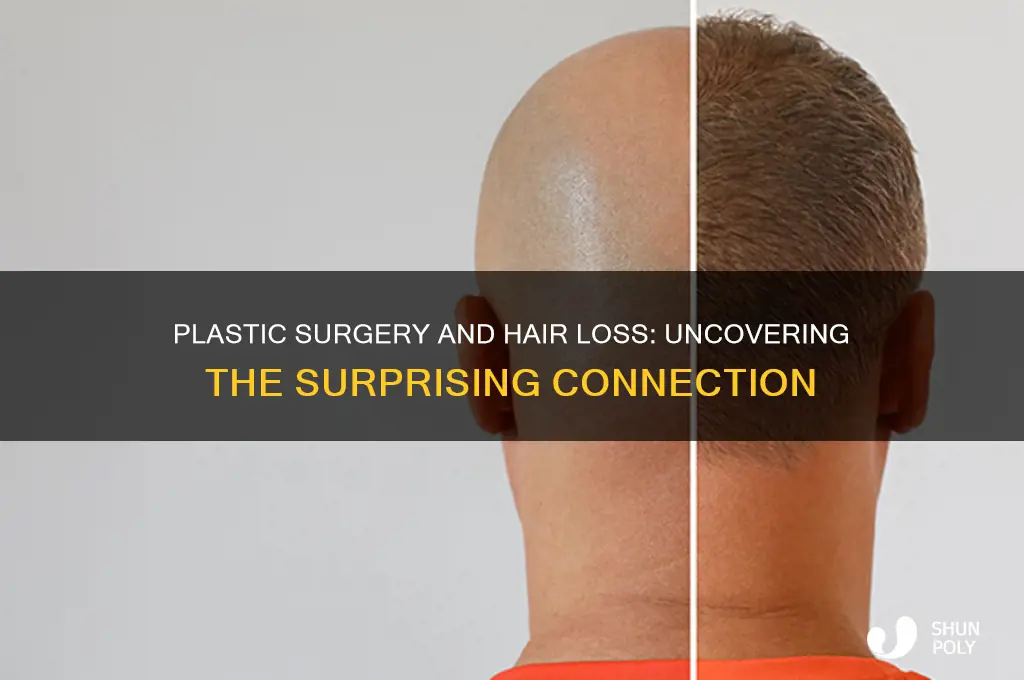 can plastic surgery cause hair loss