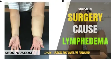 Plastic Surgery and Lymphedema: Understanding the Potential Risks and Connection