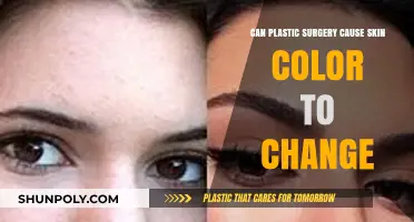 Does Plastic Surgery Alter Skin Pigmentation? Understanding Color Changes Post-Procedure