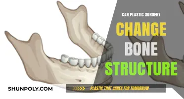 Can Plastic Surgery Alter Your Bone Structure? Facts Revealed