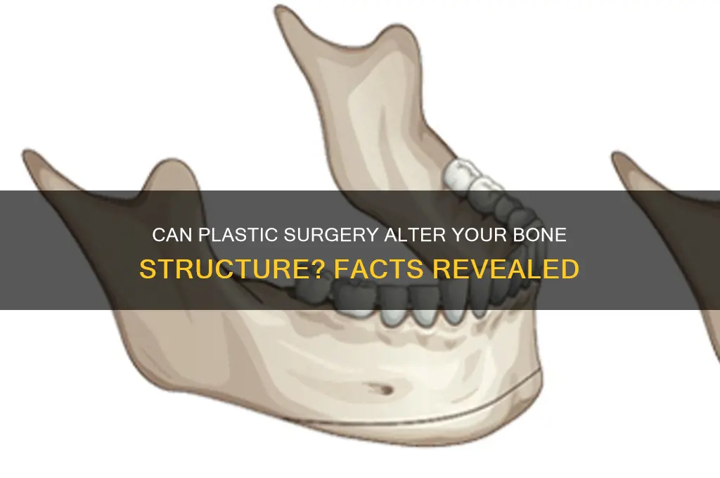 can plastic surgery change bone structure