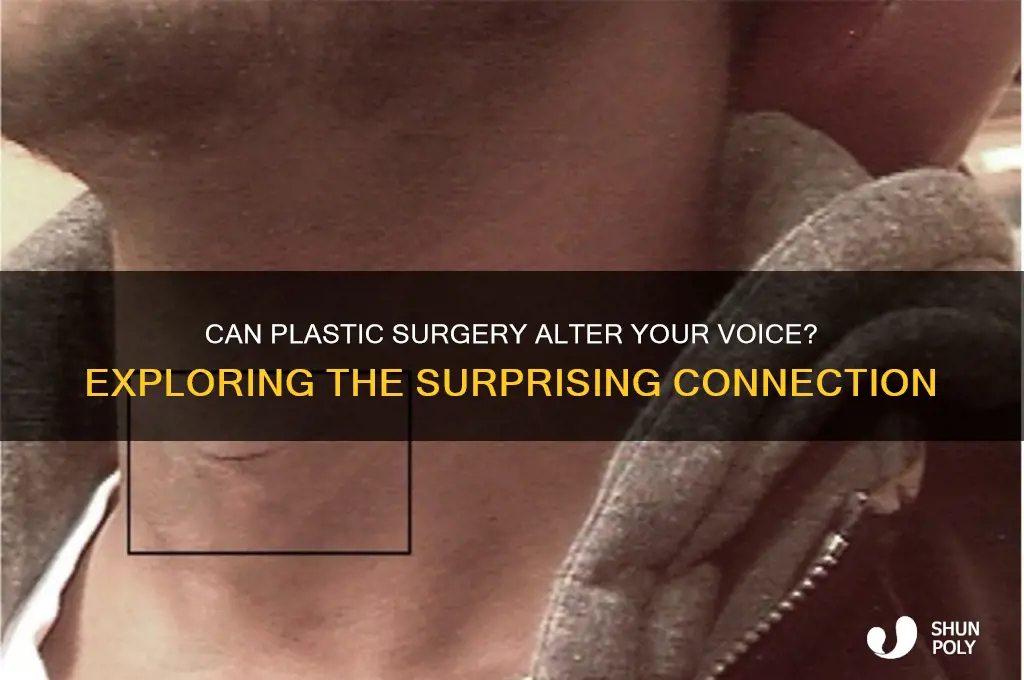 can plastic surgery change your voice