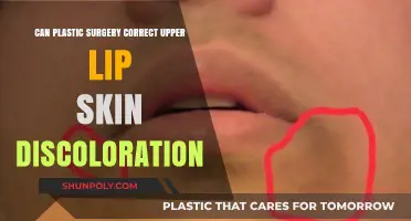 Correcting Upper Lip Skin Discoloration: Can Plastic Surgery Help?