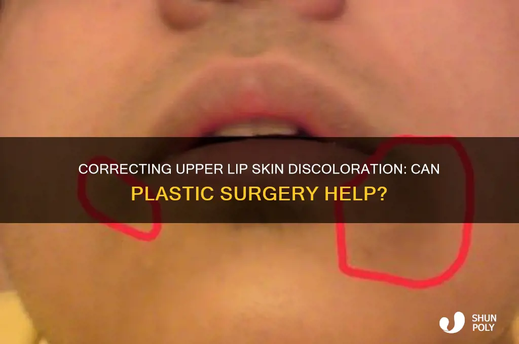 can plastic surgery correct upper lip skin discoloration