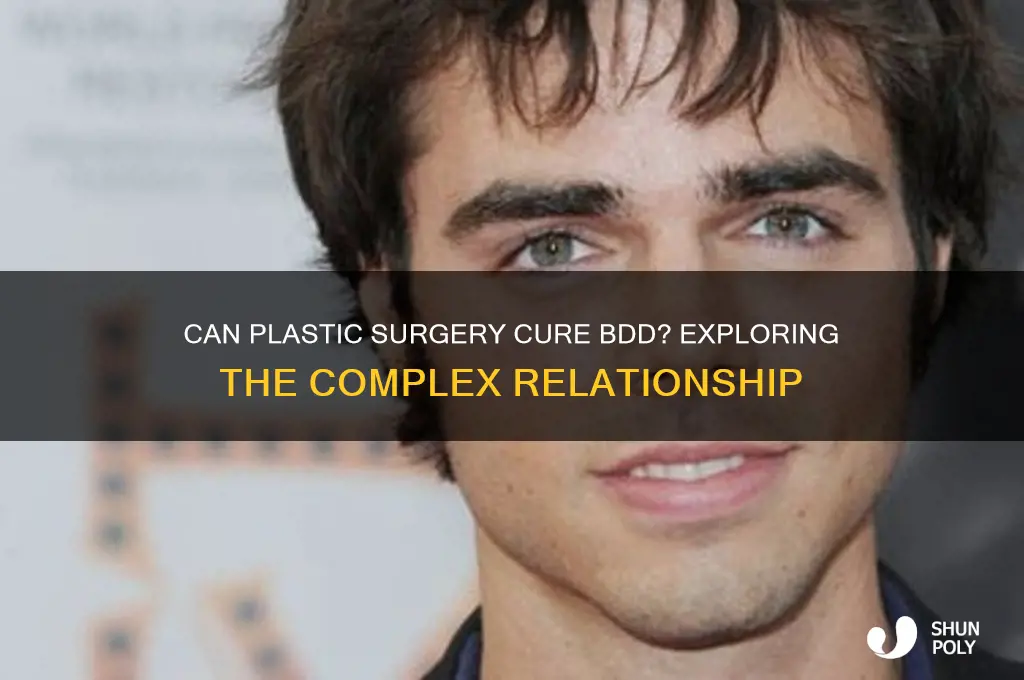 can plastic surgery cure bdd