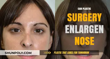 Can Plastic Surgery Enlarge Your Nose? Facts and Considerations