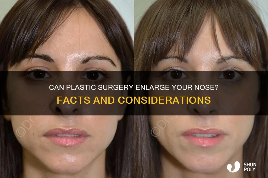 can plastic surgery enlargen nose
