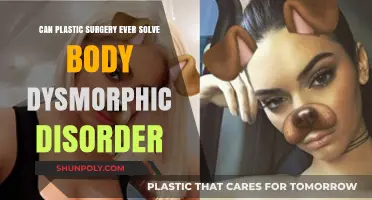 Plastic Surgery and Body Dysmorphic Disorder: A Complex Relationship